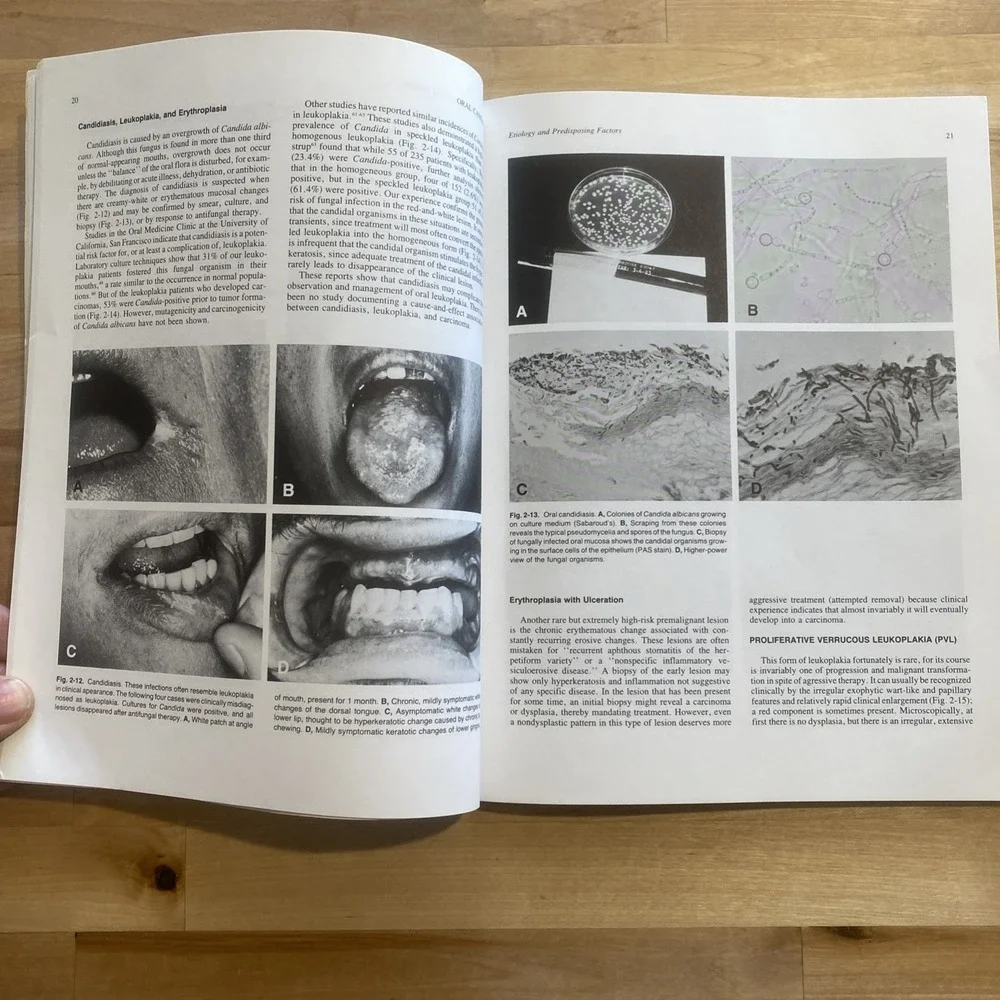 Oral‎ Cancer by Sol Silverman Jr 1985 American Cancer Society Second Edition